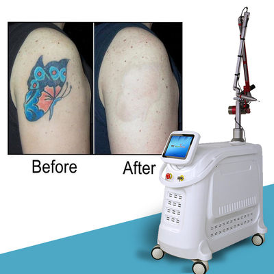 1064nm Q Switched Nd Yag Laser Пикосекундная машина для удаления татуировок