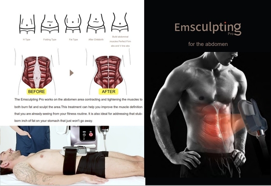 Усовершенствованный EMS Slimming Machine 150HZ частота для уменьшения целлюлита